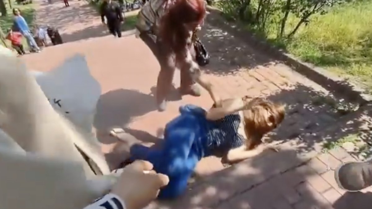 Eski manken Sevda Demirel kabusu yaşadı: Parkta bir anda ayağı kırıldı