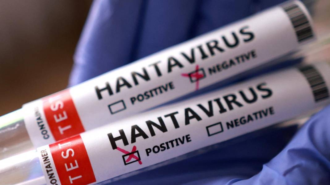 DSÖ açıkladı: Hantavirüsün dünya nüfusu için riski düşük