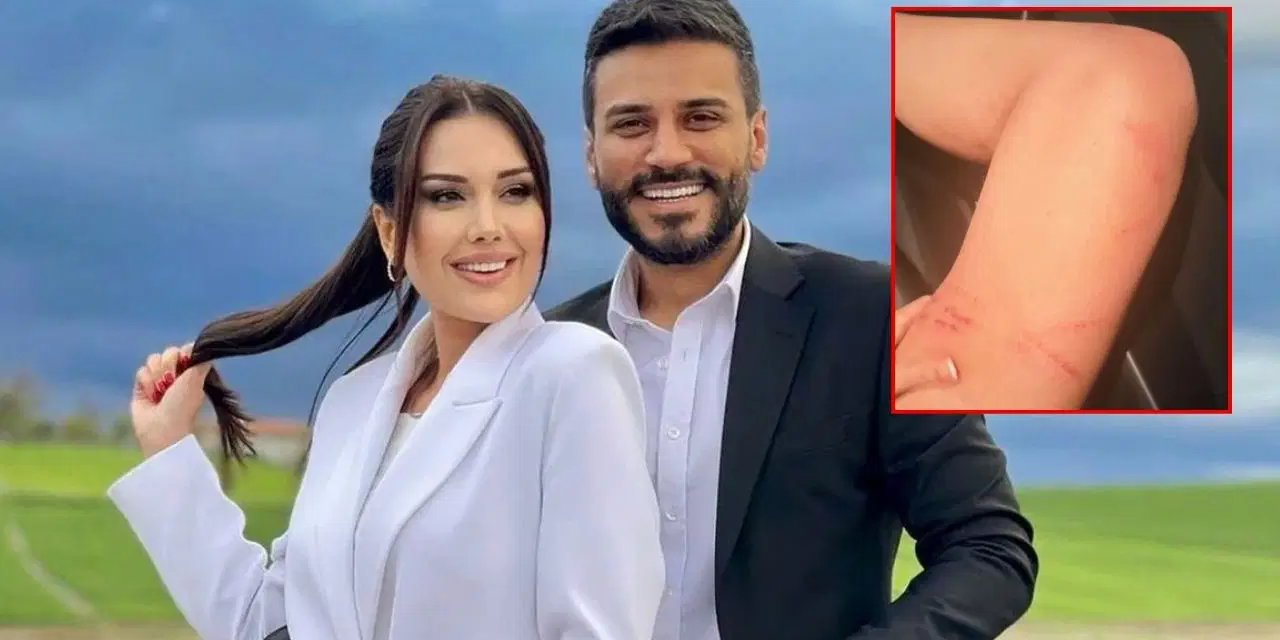 Dilan Polat ve Engin Polat cephesinde yeni kriz: Darp fotoğraflarını paylaşıp hemen sildi