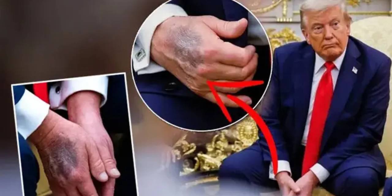 Trump'ın sağlık raporu tartışma yarattı: 'Morluk' soruları yanıtsız kaldı