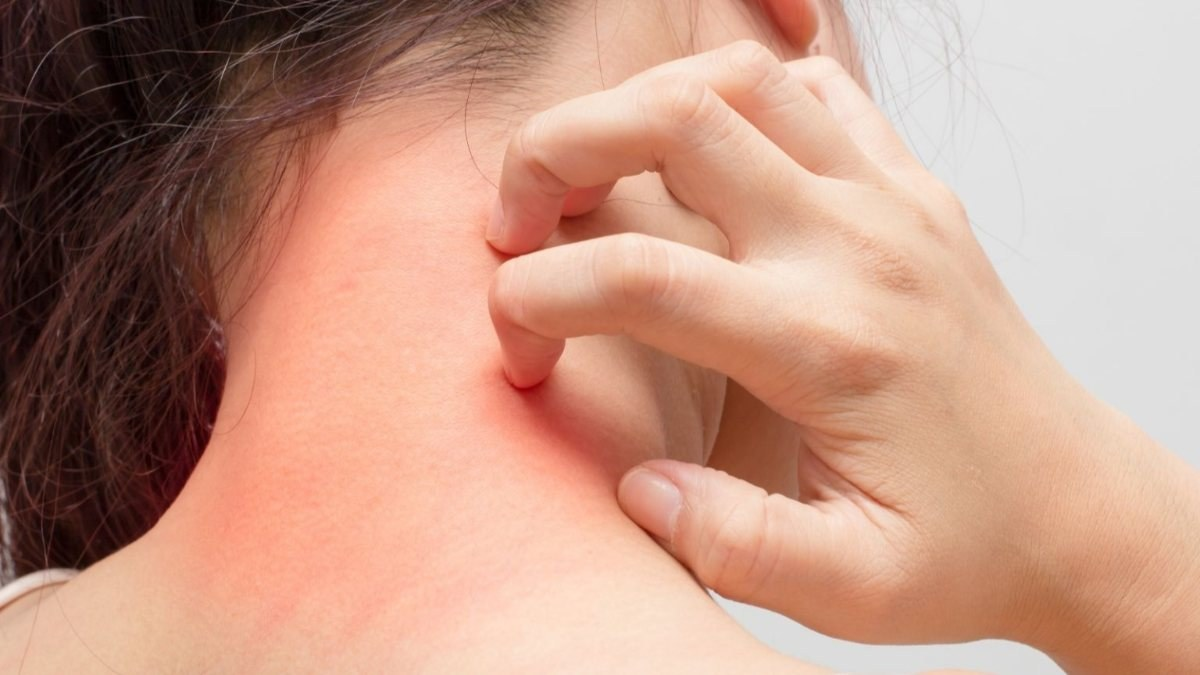 Sürekli kuru olan cildinize mucizevi nemlendirici! Kendi nemlendiricinizi kendiniz yapın