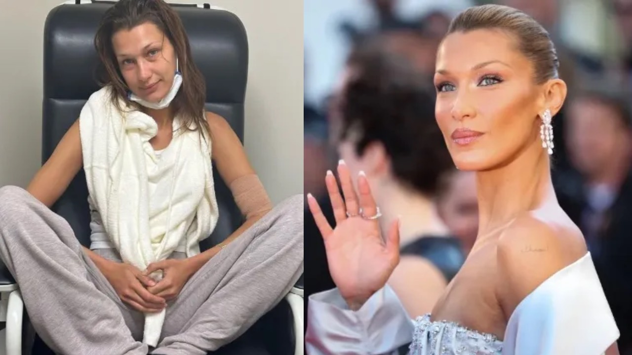 Bella Hadid paylaşımıyla hayranlarını endişelendirdi: Tedaviler işe yaramıyor!