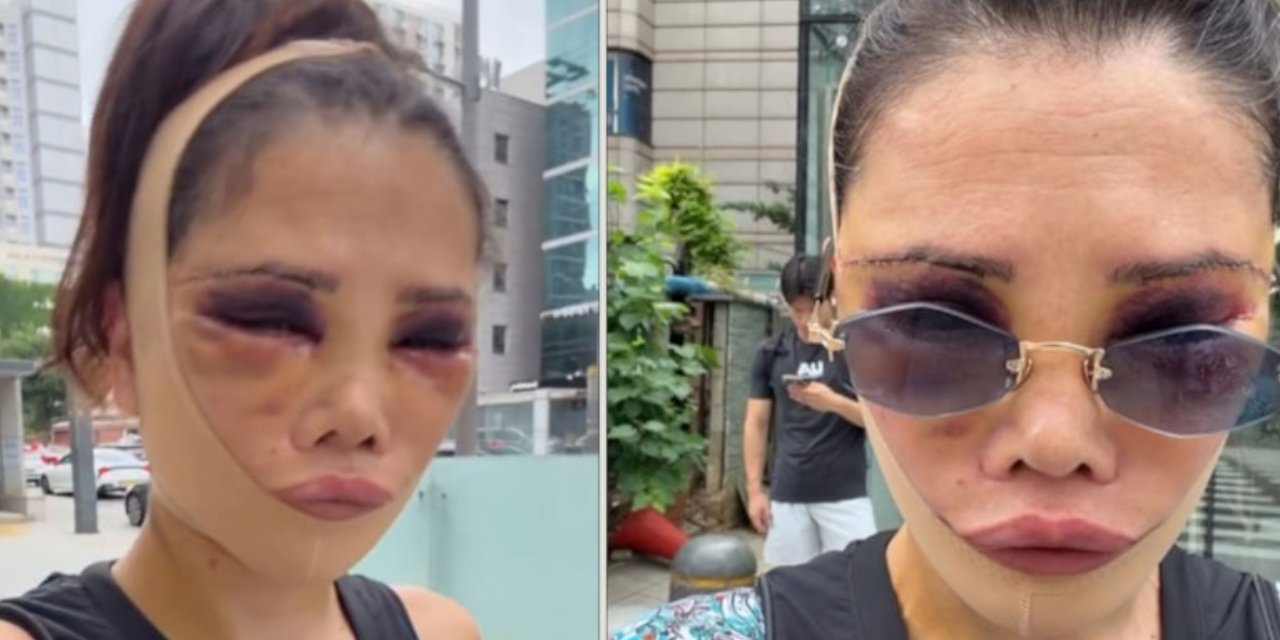 Didem Ceran Güney Kore'de ameliyatla yüz nakli yaptırmıştı: Ağlayarak isyan etti: "Beni katil gibi gösteriyorlar"