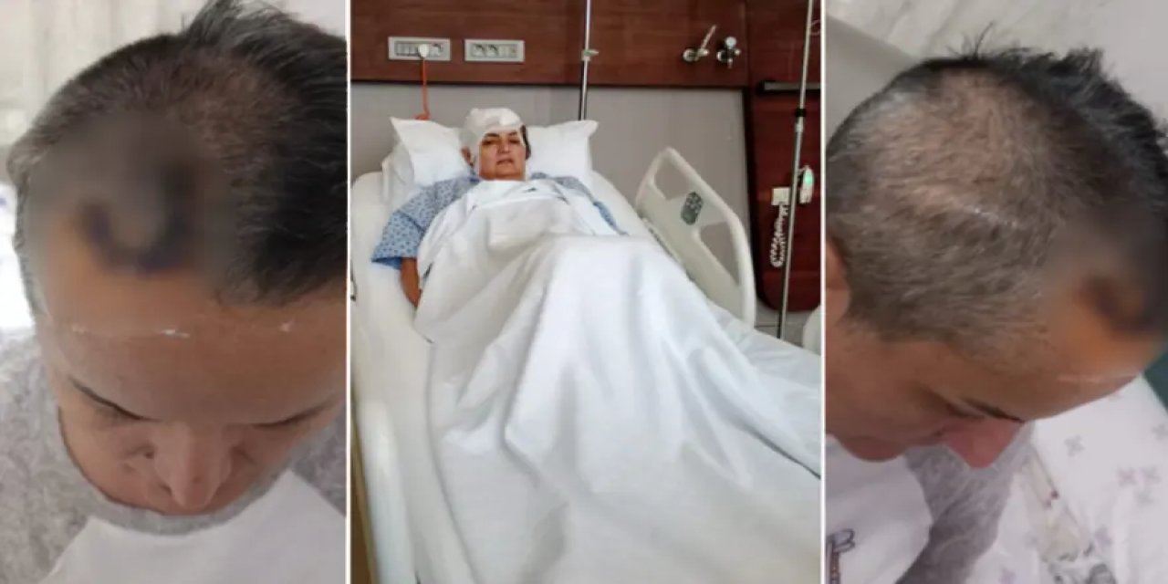 İstanbul’da implant dehşeti: Diş tedavisi sonrası beynine şant takıldı
