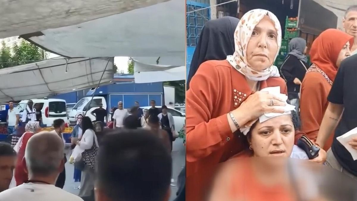 Armut tartışması kanlı bitti: Pazarcının kalaslı saldırısında yaralanan kadının başına 10 dikiş atıldı