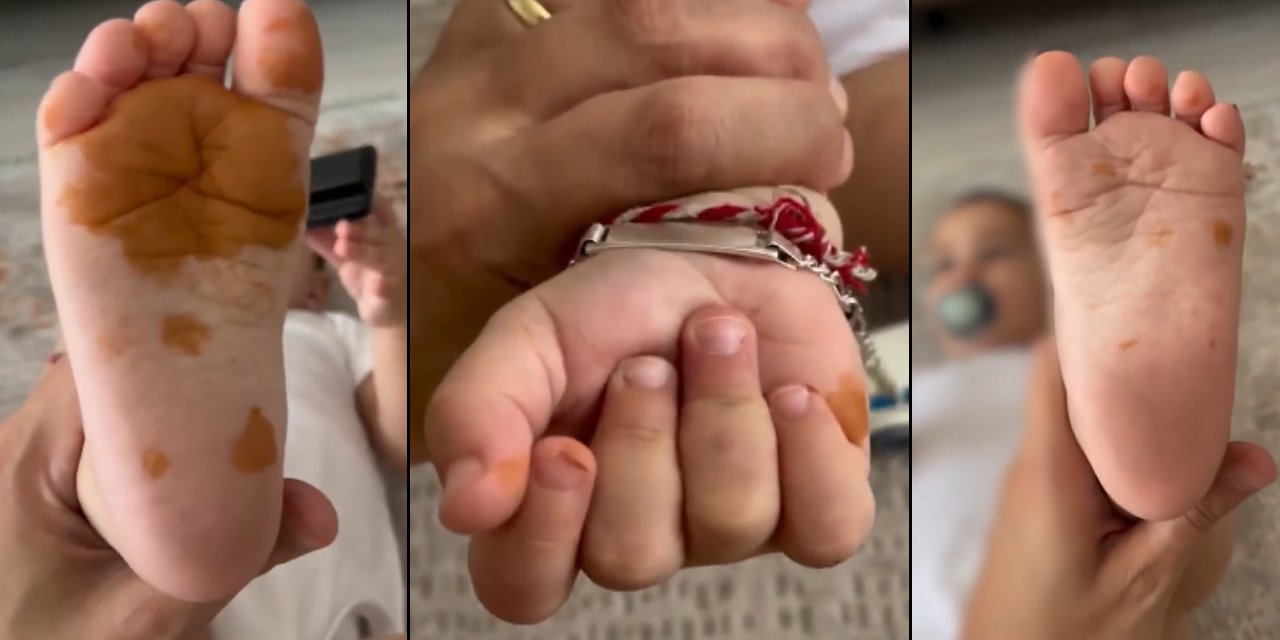 Çocuğunun el ve ayaklarını böyle görünce panikledi! Gerçek sonradan ortaya çıktı