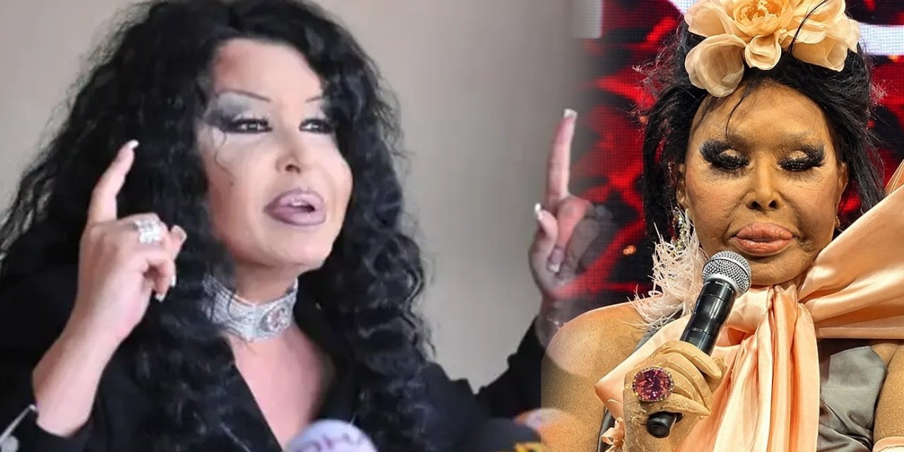 Bülent Ersoy’dan dikkat çeken estetik itirafı: “Yüzümü lolita gibi yaptırdım”