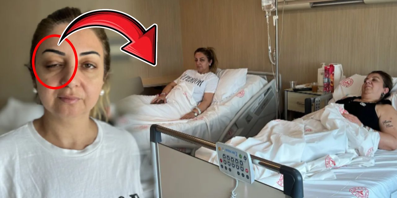 Botoks sonrası kabus! 3 kadın aynı güzellik merkezinden çıkınca çift görmeye başladı