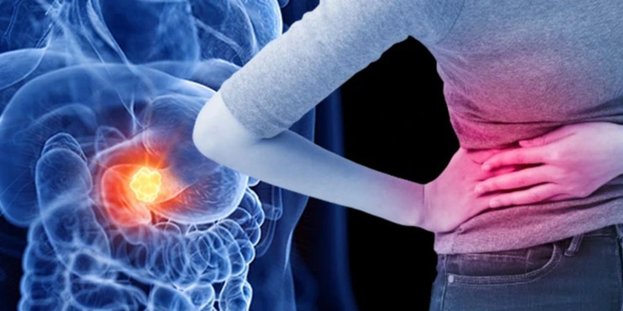 Pankreas kanserine karşı yeni dönem: Tümör oluşmadan müdahale edilecek
