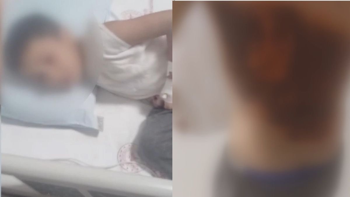 Arnavutköy'de dehşete düşüren olay: 12 yaşındaki çocuğun sırtına kolonya döküp ateşe verdiler