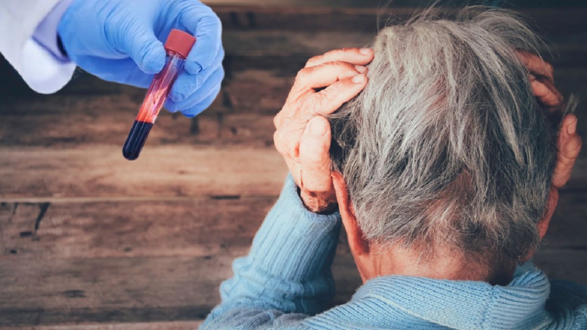 Alzheimer tedavisinde umut veren gelişme: Ameliyatsız yöntemle 10 dakikada beyin temizliği hızlandı