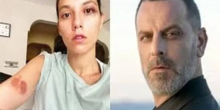Oyuncu Ozan Güven'in hapis cezası onandı