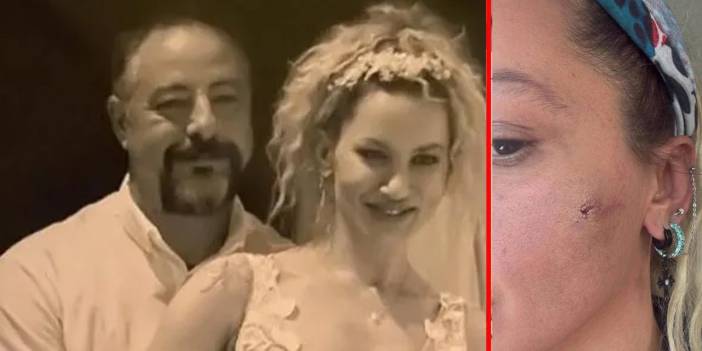 Yıldız Asyalı'nın üçüncü evliliğinde kabus! Eşinden şiddet gördüğünü açıkladı
