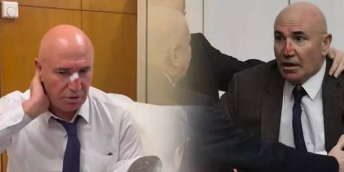 TBMM'de yemin törenindeki kavgada Mahmut Tanal yaralandı! İşte o görüntüler