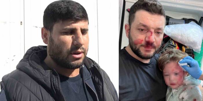 Yalova'da baba ve küçük kızına saldıran şüpheliler kendilerini böyle savununca tepkiler arttı