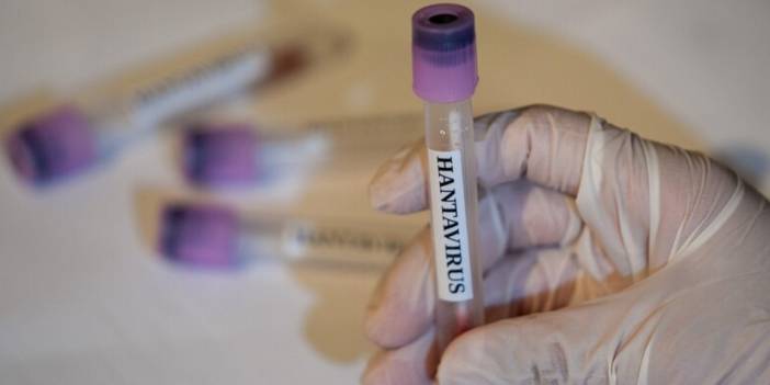 Hantavirüs paniği genişliyor: 2 ülkede daha görüldü