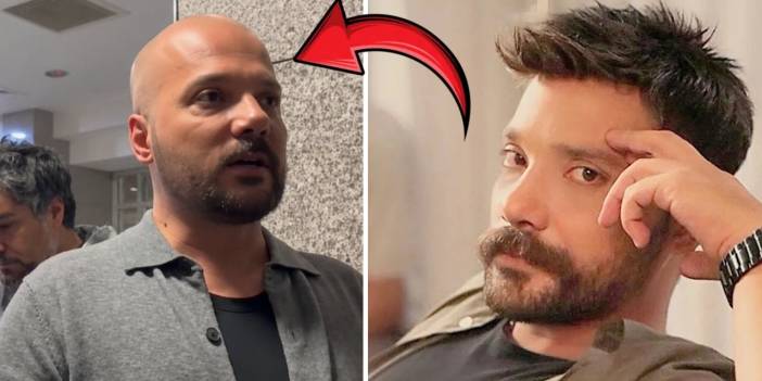Oğuzhan Uğur'un saçı protez mi? Protez saçını emniyete mi teslim etti?