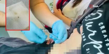Halsizlik şikayeti ile gitti karnında kene çıktı