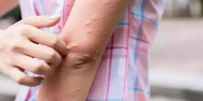 Komşuda Batı Nil Virüsü alarmı: Son bir haftada 2 kişi hayatını kaybetti