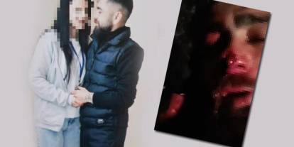 Ankara'da kan donduran olay! Evli kadından eski sevgilsine işkence: Burnu ve kulağı koptu