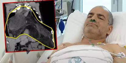 Türkiye'de bilinen ilk vaka! Karpuz alırken fark etti doktorlar bile şoke oldu