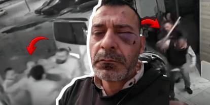 Bu kez boşanma aşamasındaki erkek korkunç şekilde darp edildi: Eski eşi ailesiyle birlikte sopalarla iş yerini bastı