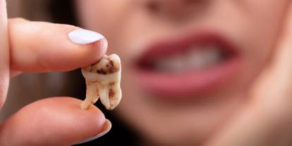 Diş çürüğüne son! Bilim insanlarından dev buluş