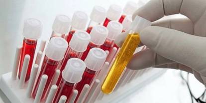 Dünyada sadece 50 kişide var! Bir damlası altın değerinde kan