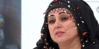 Esra Erol programıyla tanınmıştı! Yazgül Bayat estetik sonrası son halini paylaştı