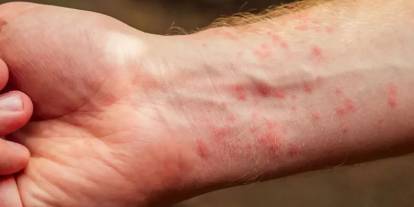 3 yıl süren vakalar var: 30 yılda vakalar pik yaptı