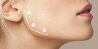 Diş sıkma sorunu olanlar dikkat: Masseter botoksu nedir, çok acıtır mı? Estetik mi tedavi mi?