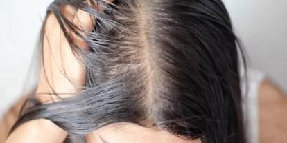 Saç yağlanması nedir, neden ortaya çıkar? Altın değerinde bakım rehberi