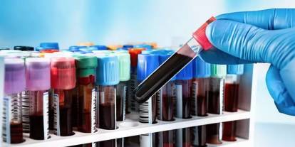 Doktorlar şoke oldu! Kan testinde iki cinsiyet tespit edildi