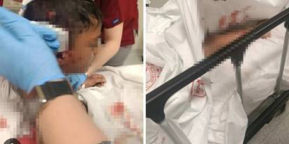 Sokak köpeği 8 yaşındaki çocuğa saldırdı! Görüntüsü kahretti