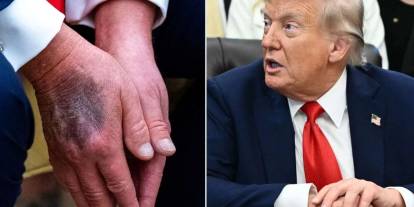 Trump’ın elindeki morlukların sırrı çözüldü