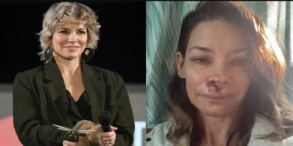 Ünlü Marvel yıldızı ölümden döndü: Evangeline Lilly kayanın üstüne düştü