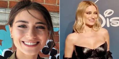 Eski hali tartışılıyordu! Hazal Kaya diş estetiği sürecini anlattı