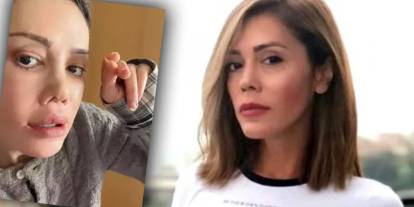 Survivor yarışmacısı Didem Ceran 'kaşımda saç çıktı' diyerek paylaştı