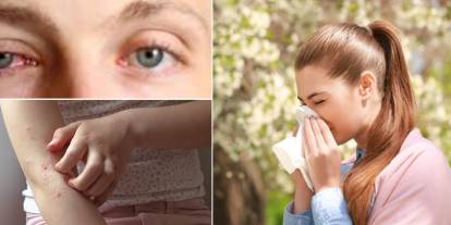 Bahar alerjisi uyarısı: Polen sezonu uzadı, erken tedavi büyük önem taşıyor