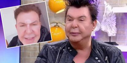 Kuşum Aydın yüz gerdirme sonrası son halini paylaştı