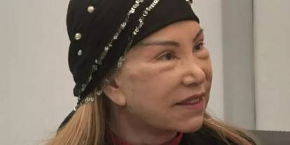 Bedia Akartürk’ün yüz germe sonrası son hali ortaya çıktı