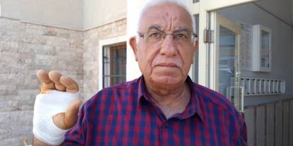 Asansörde dehşet: Komşusu parmağını ısırarak kopardı