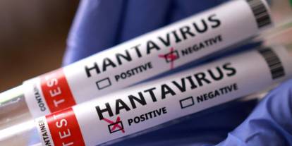 Sağlık Bakanlığı’ndan Hantavirüs açıklaması: Test sonuçları belli oldu