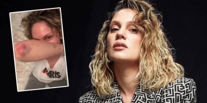 Farah Zeynep Abdullah'tan korkutan kare: Her yeri morluklar içinde kaldı
