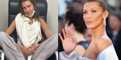 Bella Hadid paylaşımıyla hayranlarını endişelendirdi: Tedaviler işe yaramıyor!