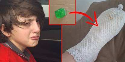 Buzdolabına koymak felaket oldu: Stres oyuncağı 11 yaşındaki çocuğun ayağını yaktı