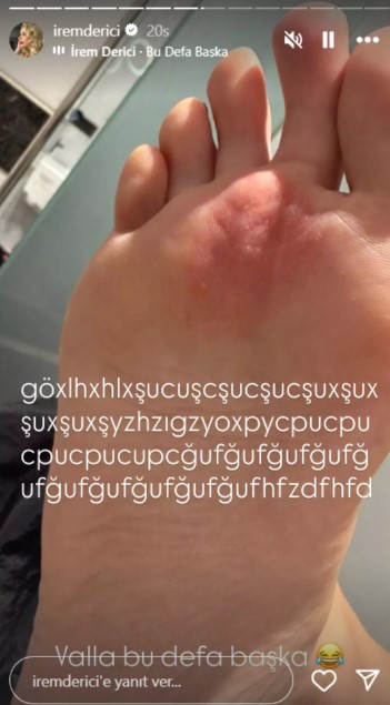 irem-derici-ayak.jpg