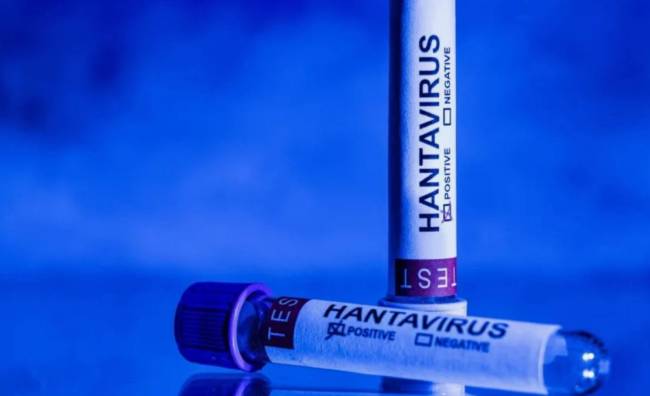 hantavirus1.jpg
